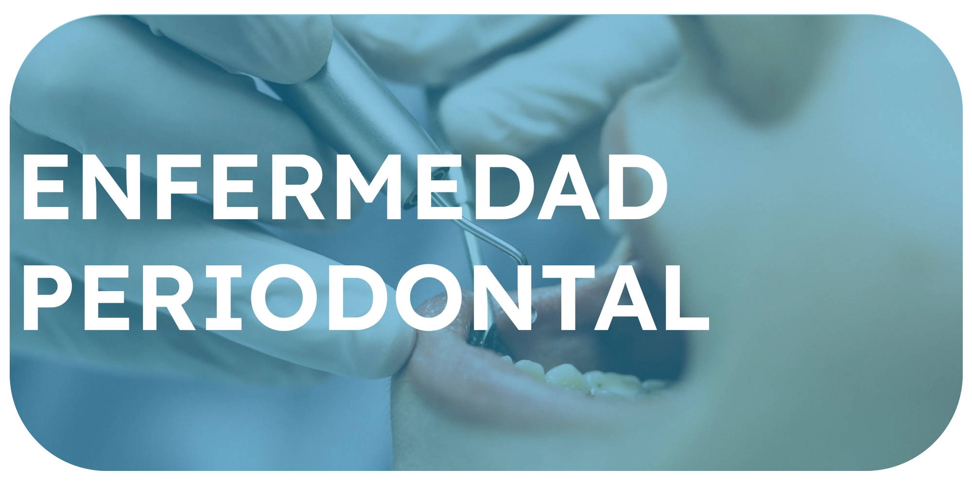 Periodoncia