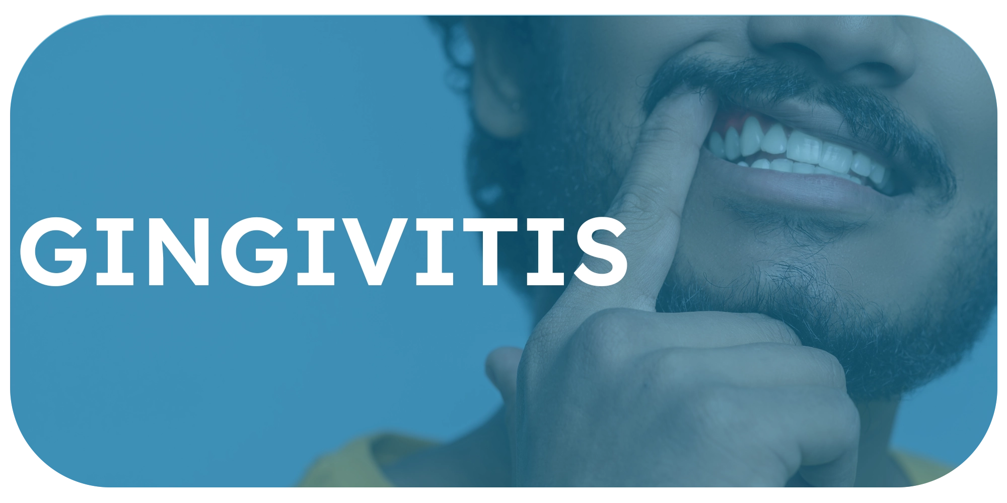 Gingivitis