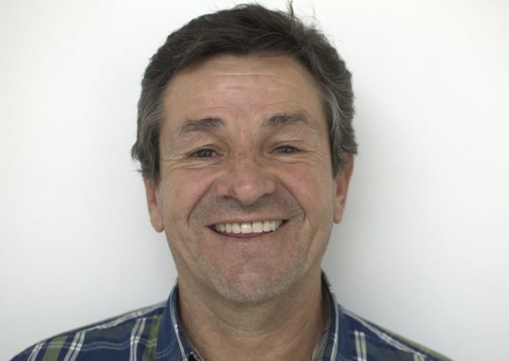 Resultado después de rehabilitación oral con implantes dentales y coronas de Zirconio en Clínica Odontia